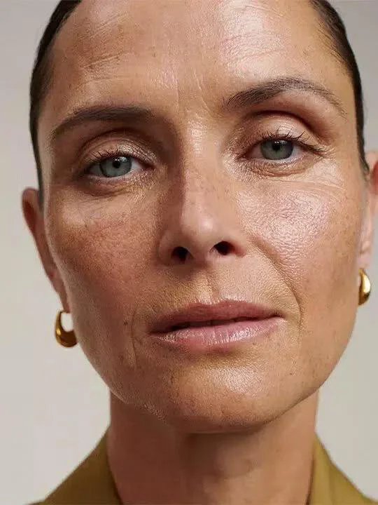 Neutralizar hiperpigmentación